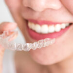 Se ha puesto de moda la ortodoncia invisible pero la pregunta principal es ¿Invisalign o brackets?