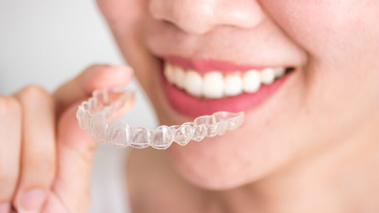 Lee más sobre el artículo Se ha puesto de moda la ortodoncia invisible pero la pregunta principal es ¿Invisalign o brackets?