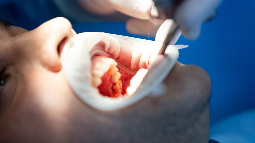 Hombre en consulta con el dentista