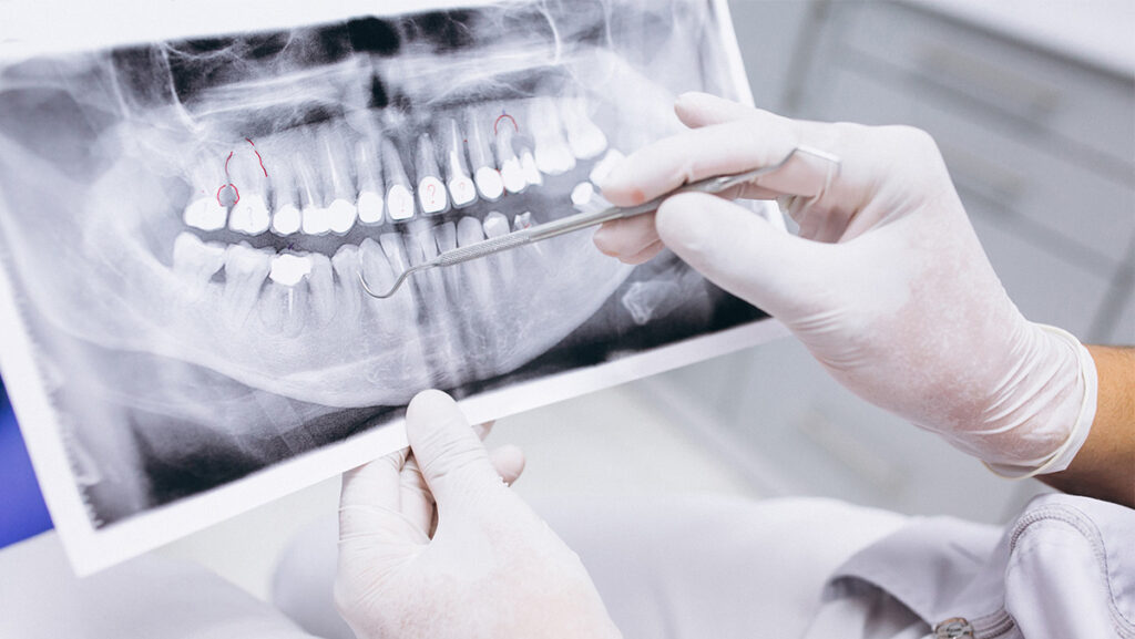 Médico maxilofacial revisando una radiografía de dientes