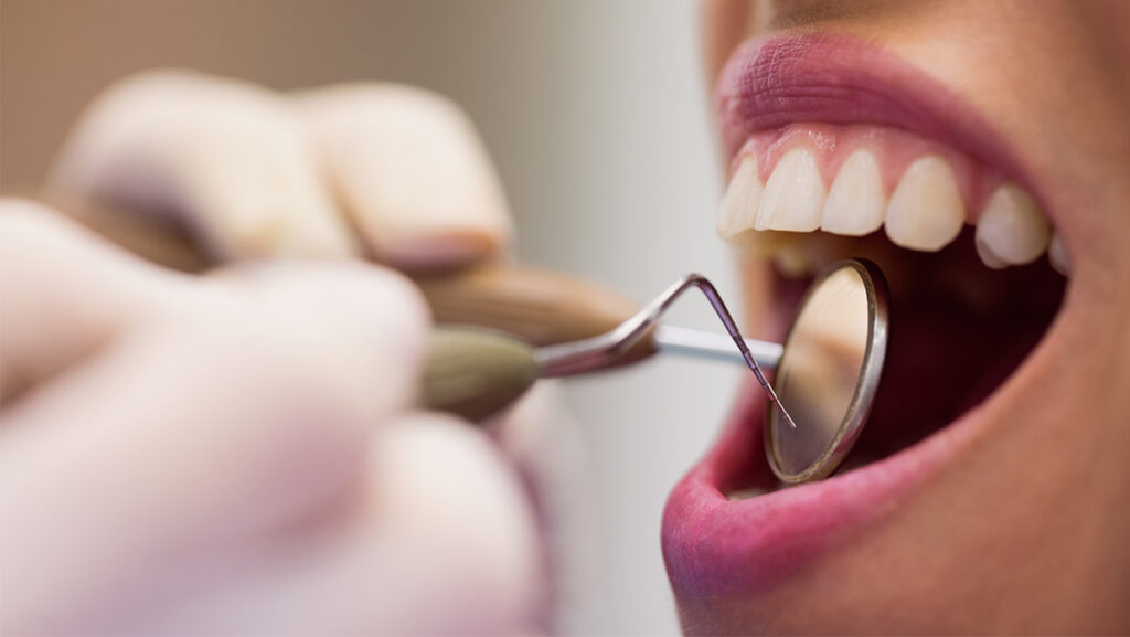 Mujer con boca abierta en consulta con dentista