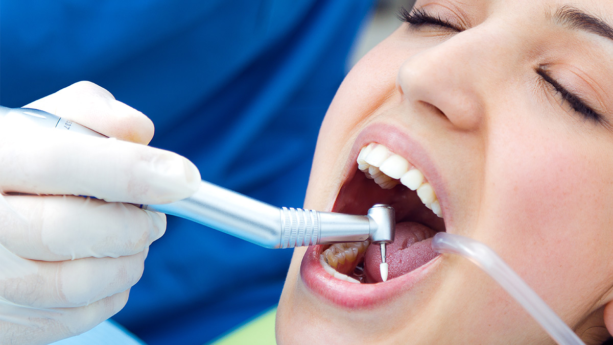 Mujer con boca abierta en consulta con odontólogo