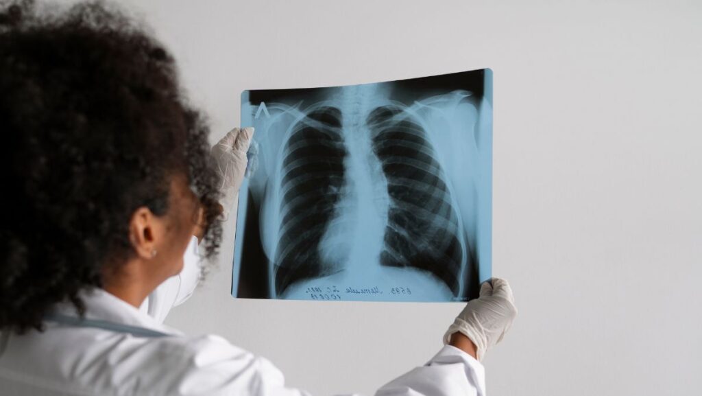 Doctora viendo radiografía de pulmones