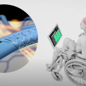 Lee más sobre el artículo Apple y Synchron desarrollan interfaces cerebro computadora: ¿Por qué podría revolucionar la medicina?