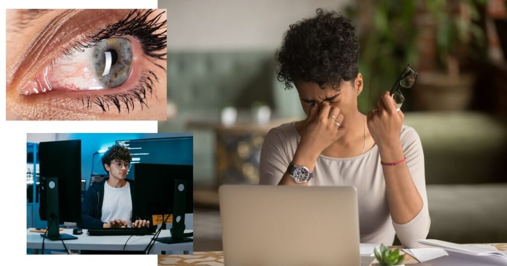 Imagen que muestra fatiga ocular por trabajo frente a computadora